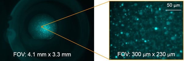 mfi zoom